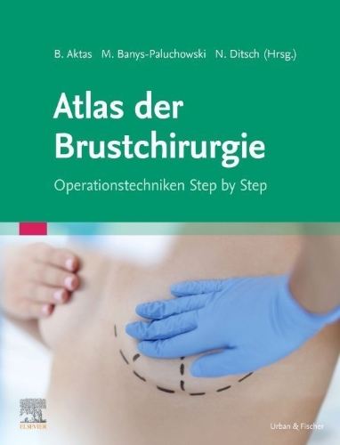 Buchcover und Innenansicht für das Buch: Onkoplastische und rekonstruktive Brustchirurgie