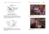 Buchcover und Innenansicht für das Buch: Endometriose - Die verkannte Frauenkrankheit