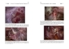 Buchcover und Innenansicht für das Buch: Endometriose - Die verkannte Frauenkrankheit